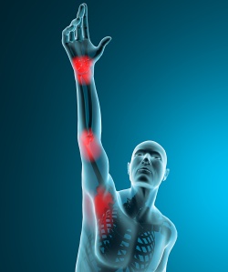 Uomo ai raggi x stiramento dolore braccio